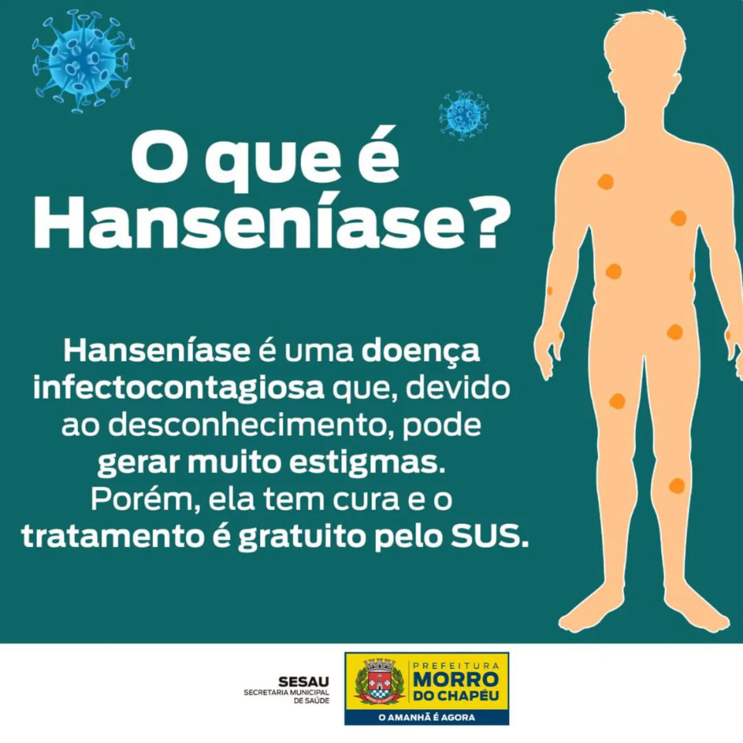 Tipo de hanseníase  Você sabia que é fundamental que a hanseníase